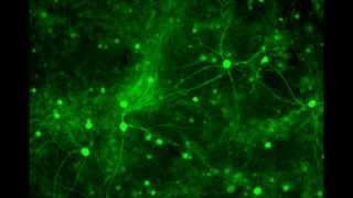 Neuronal synchronized firing  Calcium oscillation in neurons [upl. by Idnahs]