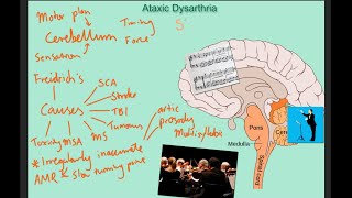 Ataxic dysarthria  samples and explanation [upl. by Feenah]