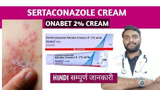 Sertaconazole cream in hindi  Onabet cream  Sertaconazole ointment [upl. by Anelleh543]