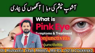 The Hidden Epidemic Viral Conjunctivitis in Pakistan  Best Treatment and Home Remedy for pink eye [upl. by Acira691]