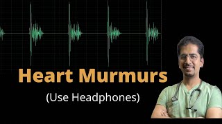 Heart Murmurs in just 20 mins use Headphones [upl. by Spanjian]