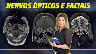 NERVOS ÓPTICOS FACIAIS COMO INTERPRETAR A RESSONÂNCIA MAGNÉTICA [upl. by Nolek7]