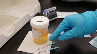 Chemistry Urine Fertility Screening Tests [upl. by Lyndel]