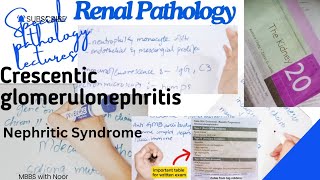 crescentic glomerulonephritis  renal pathology  nephritic syndrome  Drsamcrest [upl. by Nairb]