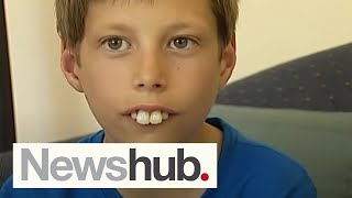 Boy bullied for buck teeth gets new smile after donations pour in  Newshub [upl. by Gapin]