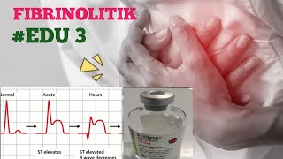 Cara Pemberian Obat Fibrinolitik pada Pasien STEMI [upl. by Nob51]