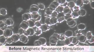 dark field microscopy before and after imrs PEMF treatment [upl. by Coplin178]