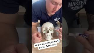 Understanding Le Fort Facial Fractures [upl. by Atnicaj]