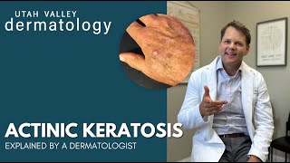 Actinic Keratosis Explained by a Dermatologist  Utah Valley Dermatology [upl. by Yelyk]