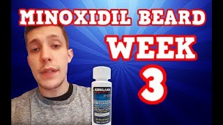 Monoxidil Beard  Week 3  Minoxidil 5 for Beard Growth  Facialfuzzfridays [upl. by Zarla]