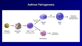 Asthma and COPD  Pathogenesis and Pathophysiology [upl. by Noslrac725]