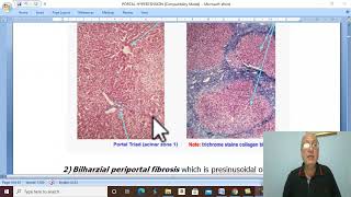 Hepatic disorders in Arabic 2  Portal hypertension  part 1  by Dr Wahdan [upl. by Alpers508]