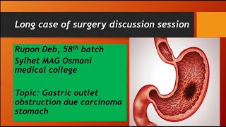 Long case03Gastric outlet obstruction due to Carcinoma stomach [upl. by Ocnarf]