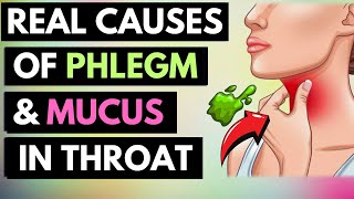 The Real Causes of Constant PHLEGM amp MUCUS In Your Throat [upl. by Shamma839]