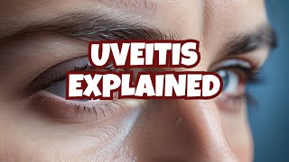 Anterior uveitis posterior uveitis and panuveitis etiology symptoms diagnosis and treatment [upl. by Maddock]