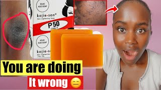 ✨HOW TO PROPERLY USE KOJIC ACID SOAP TO GET RID OF HYPERPIGMENTATION amp Dark spot [upl. by Helsell]