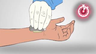 Axiostat  Vascular Haemostatic Dressing  How to use [upl. by Erodisi504]