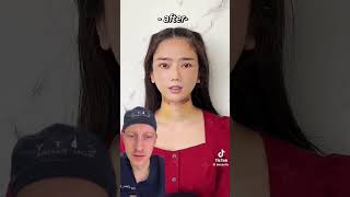 Shocking TikTok Plastic Surgery Results  Plastic Surgeon Reacts [upl. by Taylor]