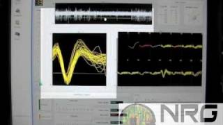 Chronic neuronal recording from microwire arrays in vivo [upl. by Cuttler970]