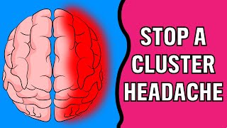 How to Stop a Cluster Headache INSTANTLY [upl. by Birch815]