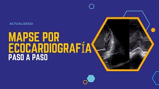 ⚠️IMPACTANTE ✅MAPSE por ECOCARDIOGRAFIA Paso a Paso [upl. by Yrrehs]