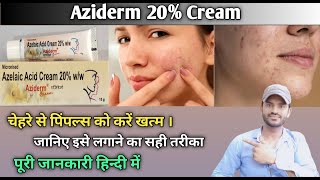 Aziderm 20 cream use benefits and side effects full review in hindi [upl. by Darra]