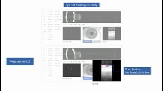 ZEISS IOLMaster 700  Unique Fixation Check [upl. by Morgen]