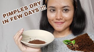 5 DAYS COFFEE MASK REVIEW ON ACNE PRONE SKIN ENGID [upl. by Pyotr]