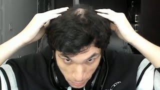 trainwreckstv is actually going bald [upl. by Ad]