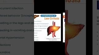 what is liver cirrhosiscauses sign amp symptomscomplicationpreventiontreatmentshorts video 🔚 [upl. by Alleb700]