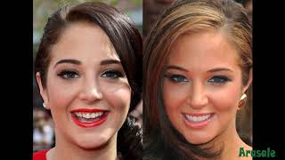 Celebrity teeth before and after [upl. by Adnoma326]