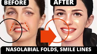 HOW TO GET RID OF NASOLABIAL FOLDS WITH FACE YOGA  LAUGH LINES SAGGY SKIN JOWLS FOREHEAD [upl. by Brietta]