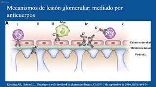 Enfermedades Glomerulares primarias y secundarias [upl. by Eiwoh]