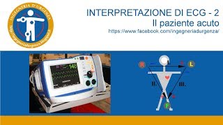 Interpretazione di ECG  2 lelettrocardiogramma nel paziente acuto [upl. by Melvina580]