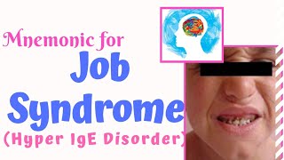 Job Syndrome Hyper IgE Syndrome Mnemonic [upl. by Almap]