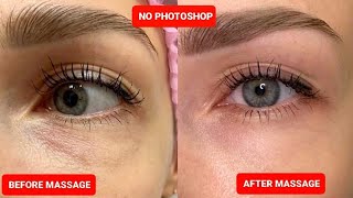 How to reduce UNDER EYE BAGS and DARK CIRCLES [upl. by Sosanna352]