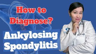 How to Diagnose Ankylosing spondylitis  Dr Diana Girnita [upl. by Earahs]