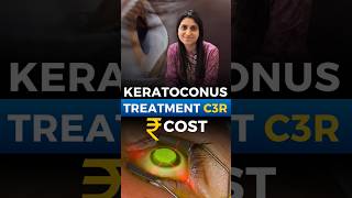 Keratoconus Treatment Cost C3R [upl. by Rask]