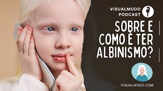 Vida de Albino Sobre e Como é Ter Albinismo  Visualmodo Podcast 86 🎙 [upl. by O'Hara]