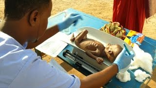 Malnutrition at record high in droughthit Somalia ICRC [upl. by Magdalen]