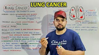 Lung Cancer Stages of cancer Causes Symptoms and treatment [upl. by Bradway]