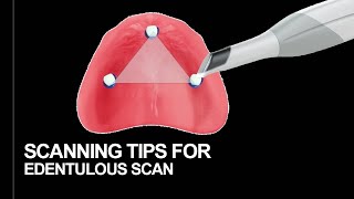 Scanning technique for Edentulous patient [upl. by Afas83]