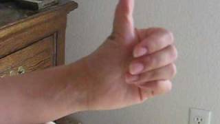 Double jointed thumb [upl. by Rodd]