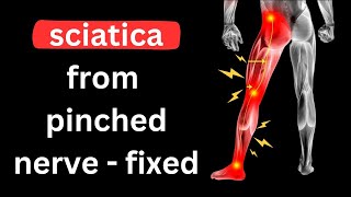 ⚡️Sciatica  Long Term Relief From A Pinched Nerve [upl. by Carolyn]