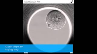 Time lapse monitoring of zona pellucida free embryos obtained through mild IVF [upl. by Jacklyn]