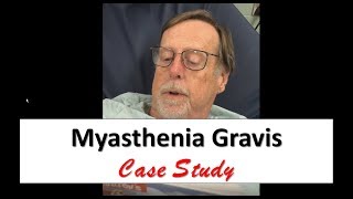 Myasthenia Gravis Case Study [upl. by Federico929]