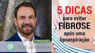 Clube da Plástica 5 dicas fundamentais para evitar a fibrose após uma lipoaspiração [upl. by Tench]