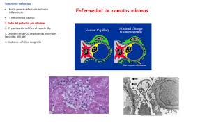 Clase 11 Enfermedades Glomerulares [upl. by Volny]