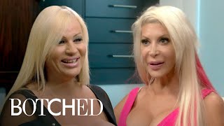 4 Botched Patients Who Want MORE amp MORE Plastic Surgery  Botched  E [upl. by Holmes]