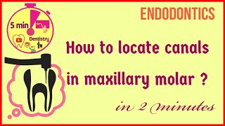 Access opening  Locating canal orifices quickly  Maxillary first molar  easy tips [upl. by Etteloc488]